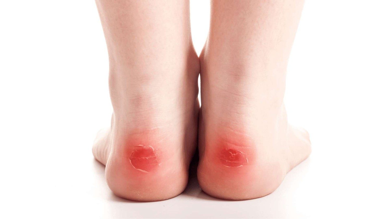 First aid kit & blister prevention
